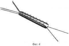 Способ формирования крестообразных связок коленного сустава (патент 2424779)