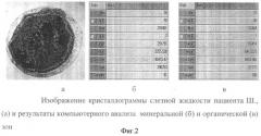 Способ дифференциальной диагностики инфекционно-воспалительных осложнений при травме глаза (патент 2356053)