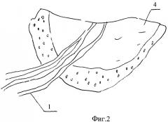 Способ устранения дефекта альвеолярного отростка челюсти (патент 2456945)