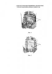 Способ укрытия обширных окончатых торакоабдоминальных дефектов (патент 2600849)