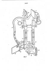 Шина для лечения переломов верхней конечности (патент 929087)