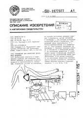 Устройство для измерения венозного давления (патент 1477377)