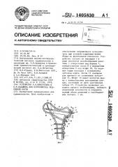 Устройство р.в.никогосяна и б.н.балашева для остеосинтеза бедренной кости (патент 1405830)