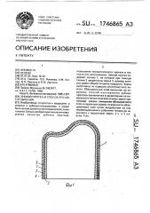 Зубной протез и способ его изготовления (патент 1746865)