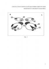 Способ топографической идентификации органов мошонки и семенного канатика (патент 2624517)
