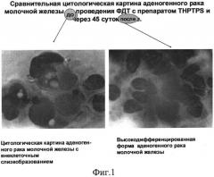 Способ фотодинамической терапии онкологических заболеваний (патент 2537759)