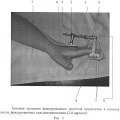 Устройство для разработки лучезапястного сустава и пальцев кисти (патент 2487695)