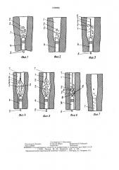 Способ удаления камней из трубчатого органа (патент 1509056)