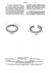 Способ пилоропластики (патент 1683697)