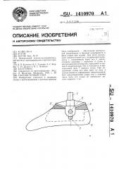 Голеностопный узел (патент 1410970)