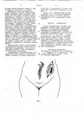 Способ оперативного лечения повреждений толстой кишки (патент 706072)