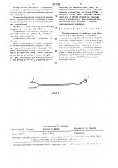 Ирригационное устройство для удаления ядра хрусталика (патент 1457925)