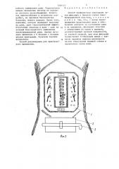 Способ профилактики эвентрации (патент 1346143)