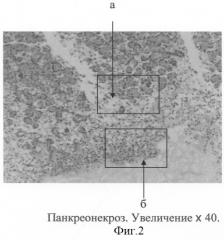 Способ моделирования острого некротического панкреатита (патент 2286608)