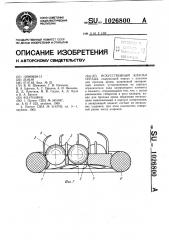 Искусственный клапан сердца (патент 1026800)