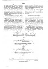 Устройство для соединения трубчатых органов (патент 589976)