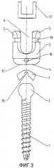 Спинальный шуруп (патент 2549017)