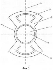 Искусственный хрусталик глаза для фиксации на край переднего капсулорексиса и/или в цилиарную борозду (патент 2523144)