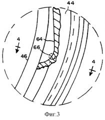 Торцевая крышка уплотнения (варианты) (патент 2269690)