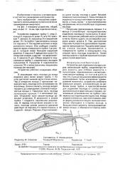 Устройство для отделения последа (патент 1688864)