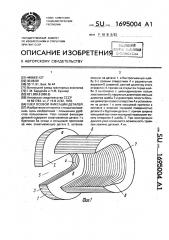 Узел осевой фиксации деталей (патент 1695004)
