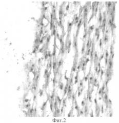 Способ лазерной диагностики этапов биотехнологии целлюляризации-децеллюляризации тканевых конструкций (патент 2343481)