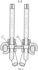 Устройство имплантируемое для коррекции искривлений позвоночника (патент 2452425)