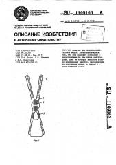 Повязка для лечения минеральной водой (патент 1109163)