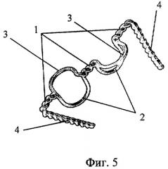 Устройство для остеосинтеза (патент 2307615)