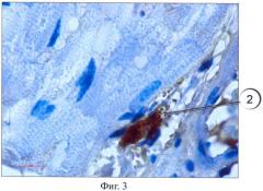 Способ идентификации тучных клеток в гистологическом препарате (патент 2418065)