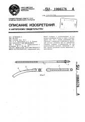 Фиксатор для внутрикостного остеосинтеза (патент 1066576)