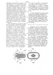 Эндопротез сустава пальца кисти (патент 1338855)