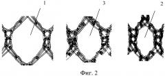 Эндопротез сетчатый основовязаный усиленный для пластики вентральных грыж (варианты) и способ его применения (патент 2524196)