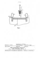 Устройство для лечения переломов нижней беззубой челюсти (патент 1271502)
