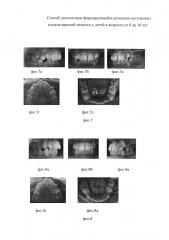Способ диагностики формирующейся ретенции постоянных клыков верхней челюсти у детей в возрасте от 8 до 10 лет (патент 2629329)