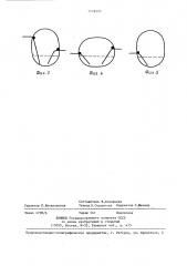 Устройство для дренирования (патент 1426595)