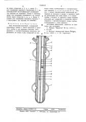 Зонд желудочно-кишечный (патент 528933)