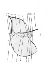 Способ лапароскопической левосторонней латеральной секторэктомии печени (патент 2628056)