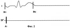 Способ оценки электрических свойств рабочего миокарда (патент 2261124)
