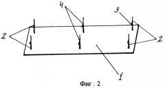 Способ фиксации синтетической сетки к крестцу (патент 2268010)
