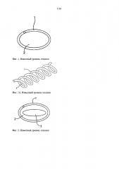 Виток в форме символа бесконечности для спиральных швов (патент 2646555)