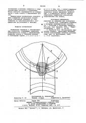 Глобоидная передача (патент 983349)