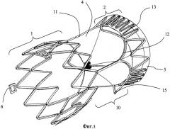Биологический протез аортального клапана сердца (патент 2479287)