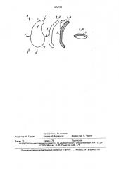 Протез стенки слухового прохода (патент 1634272)