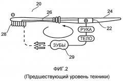 Ионообменное стоматологическое устройство и способ (патент 2363416)