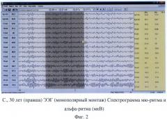 Способ диагностики функциональной межполушарной асимметрии у правшей и левшей (патент 2483672)