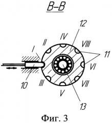 Способ восстановления мышечного корсета шейного отдела позвоночника и устройство для его осуществления (патент 2548507)