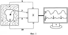 Способ регистрации механической работы изолированного сердца лягушки (патент 2479871)