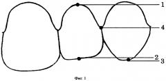 Способ определения высоты клинической коронки зуба (патент 2565999)