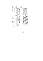 Зубной имплантат и способ его имплантации (патент 2644851)